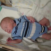 His Stay at the CDH NICU