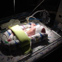 The face mask protects his eyes from the bright light used to help his jaundice.