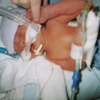 NICU Overview from a Disposable Camera